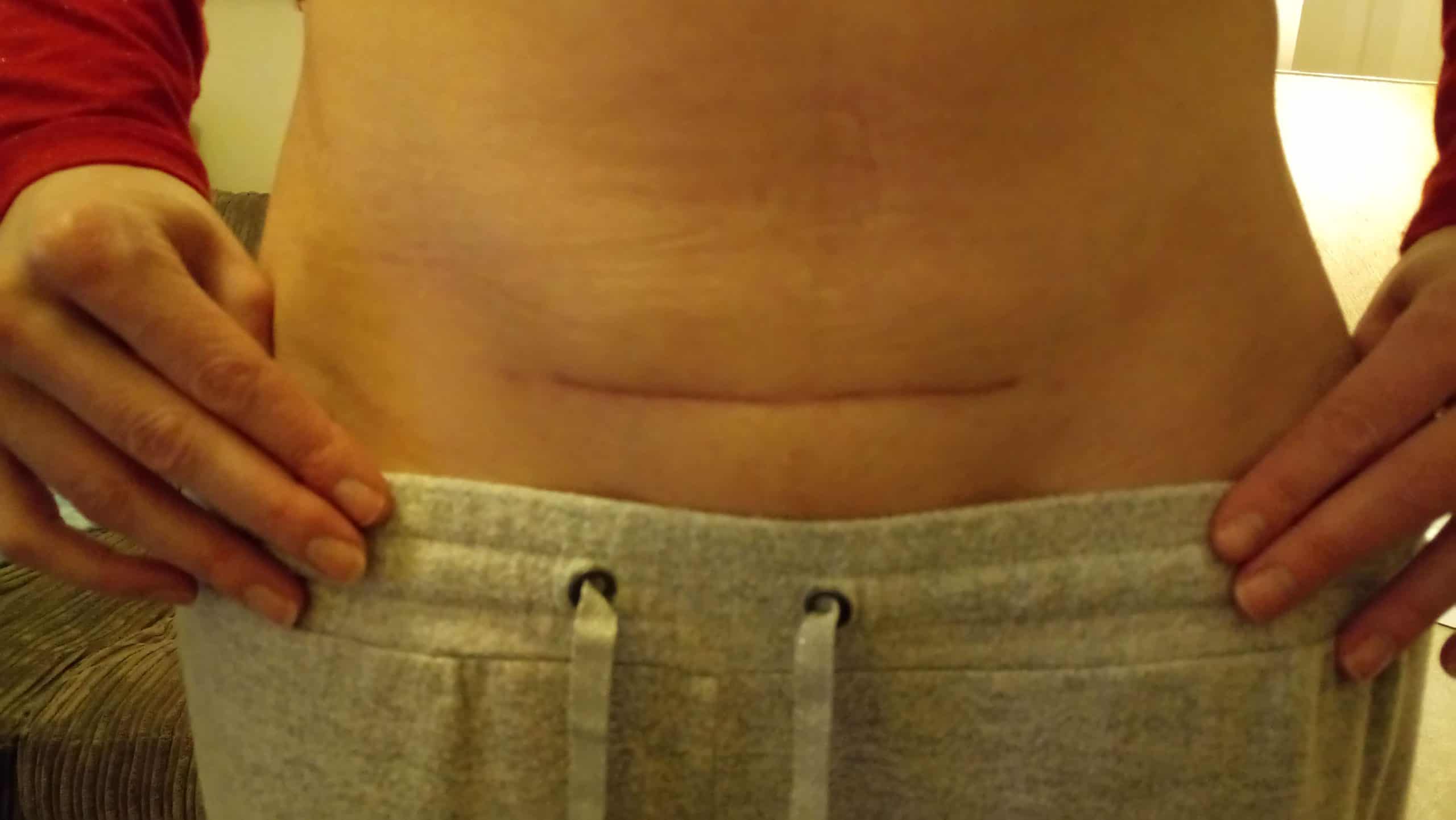 Înainte de utilizarea Nourisil™ MD