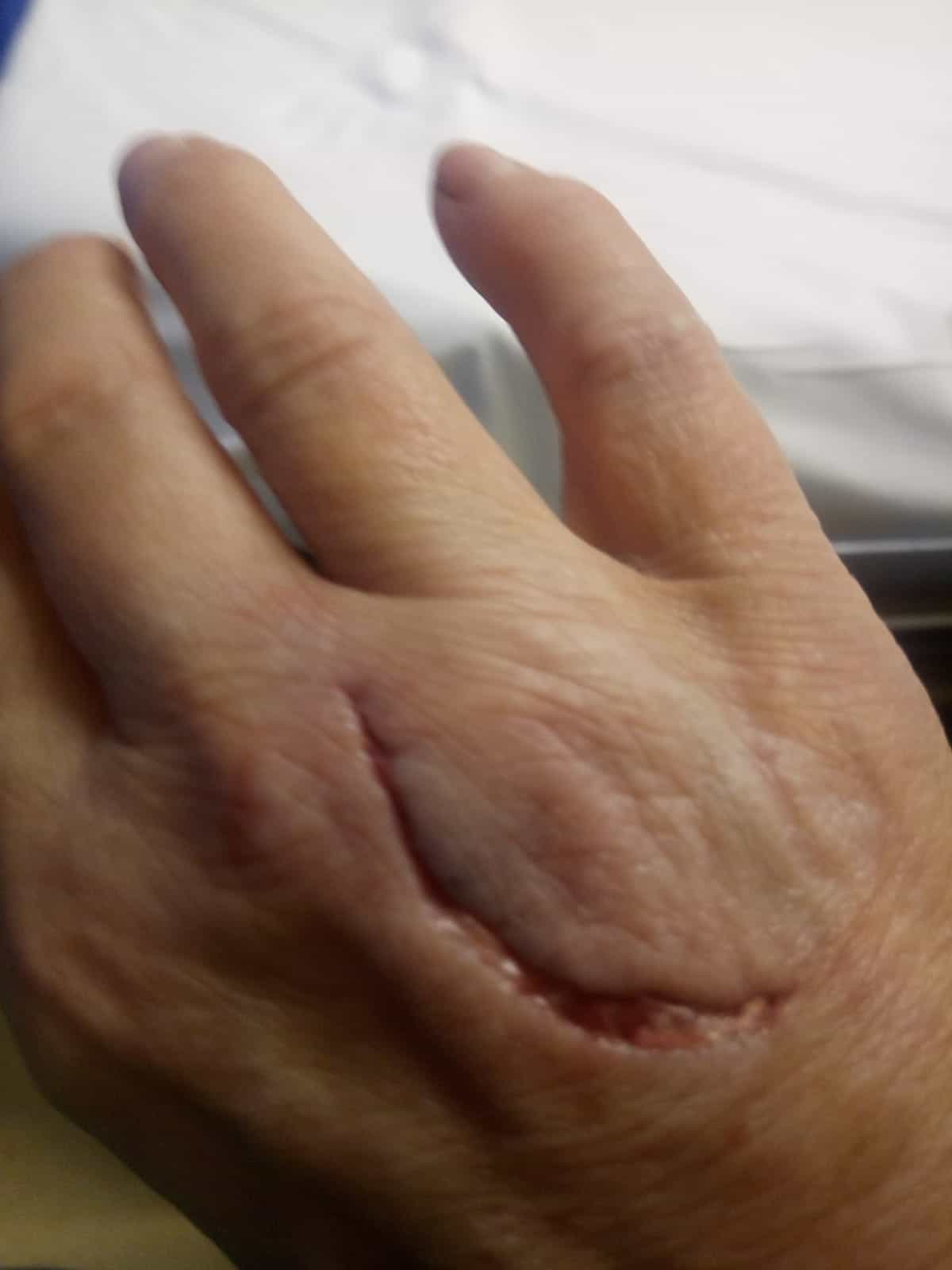 Înainte de utilizarea Nourisil™ MD