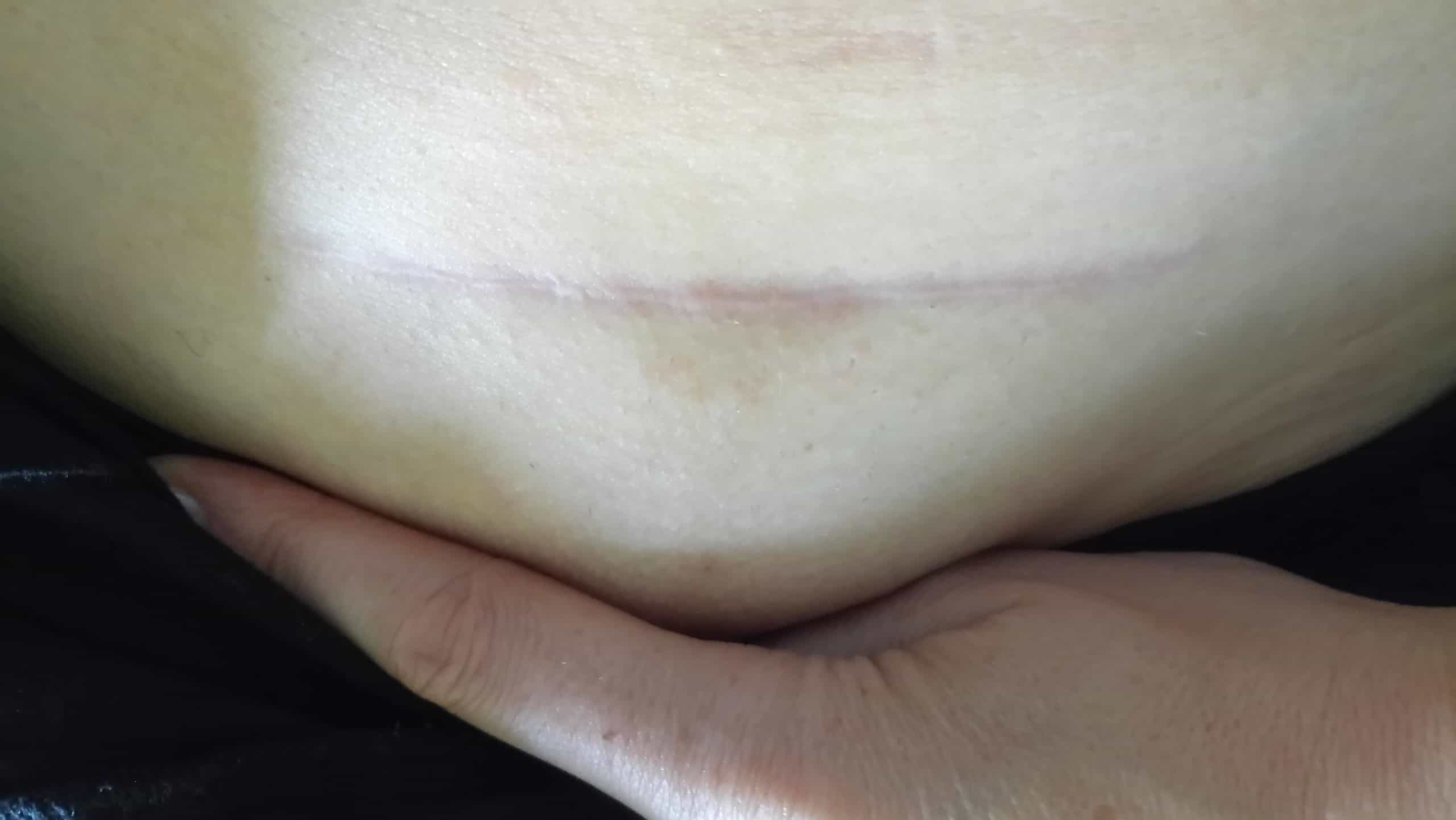 După utilizarea Nourisil™ MD