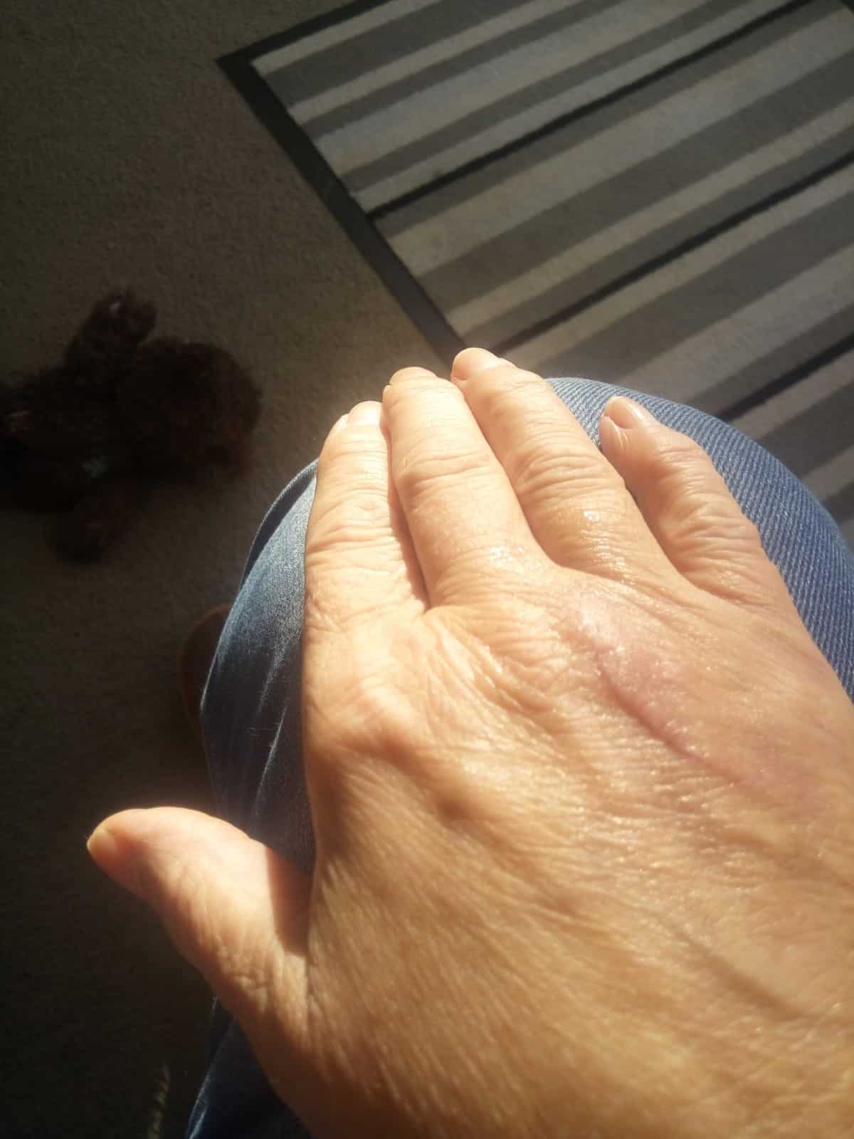 După utilizarea Nourisil™ MD