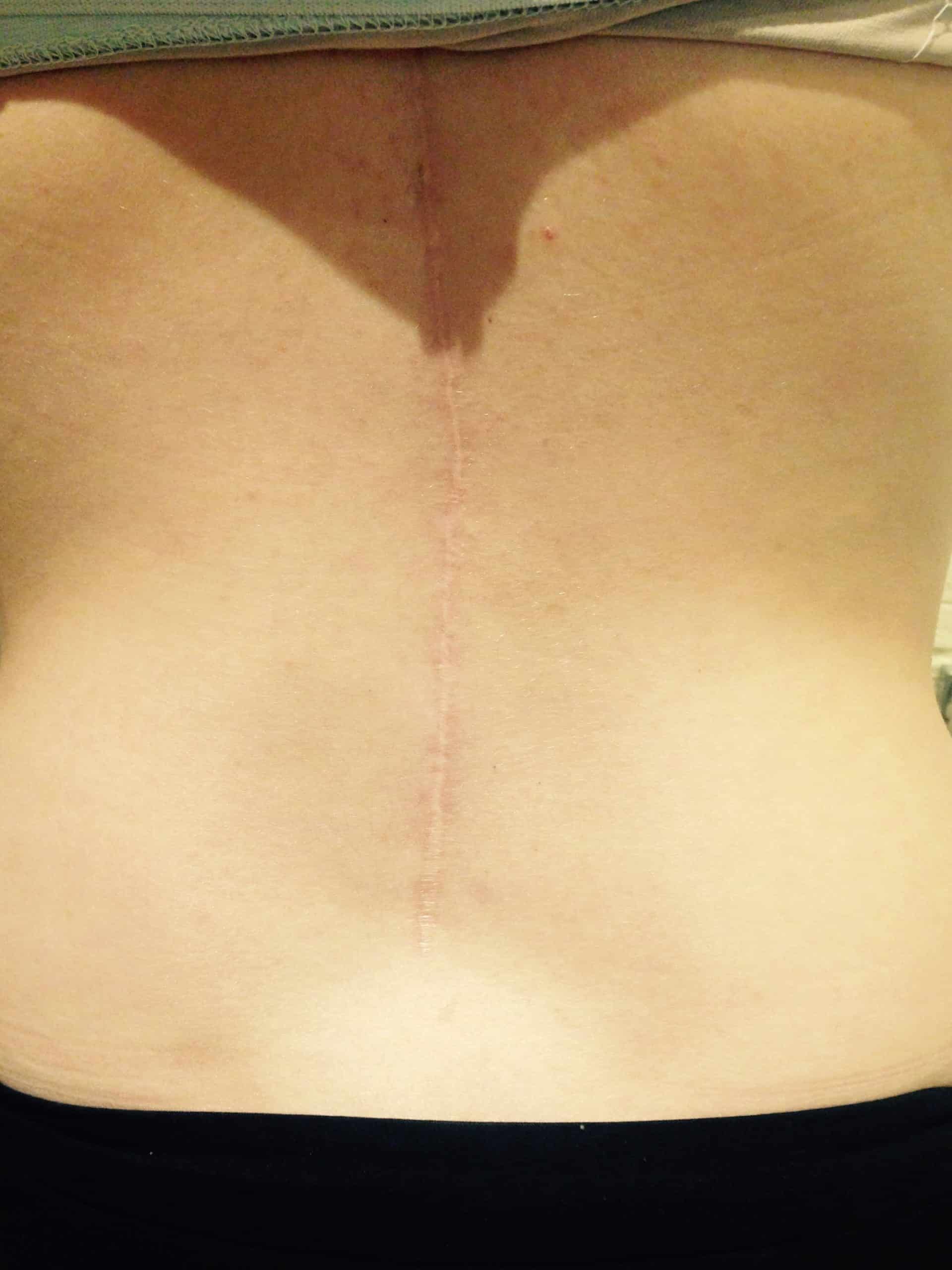 După utilizarea Nourisil™ MD