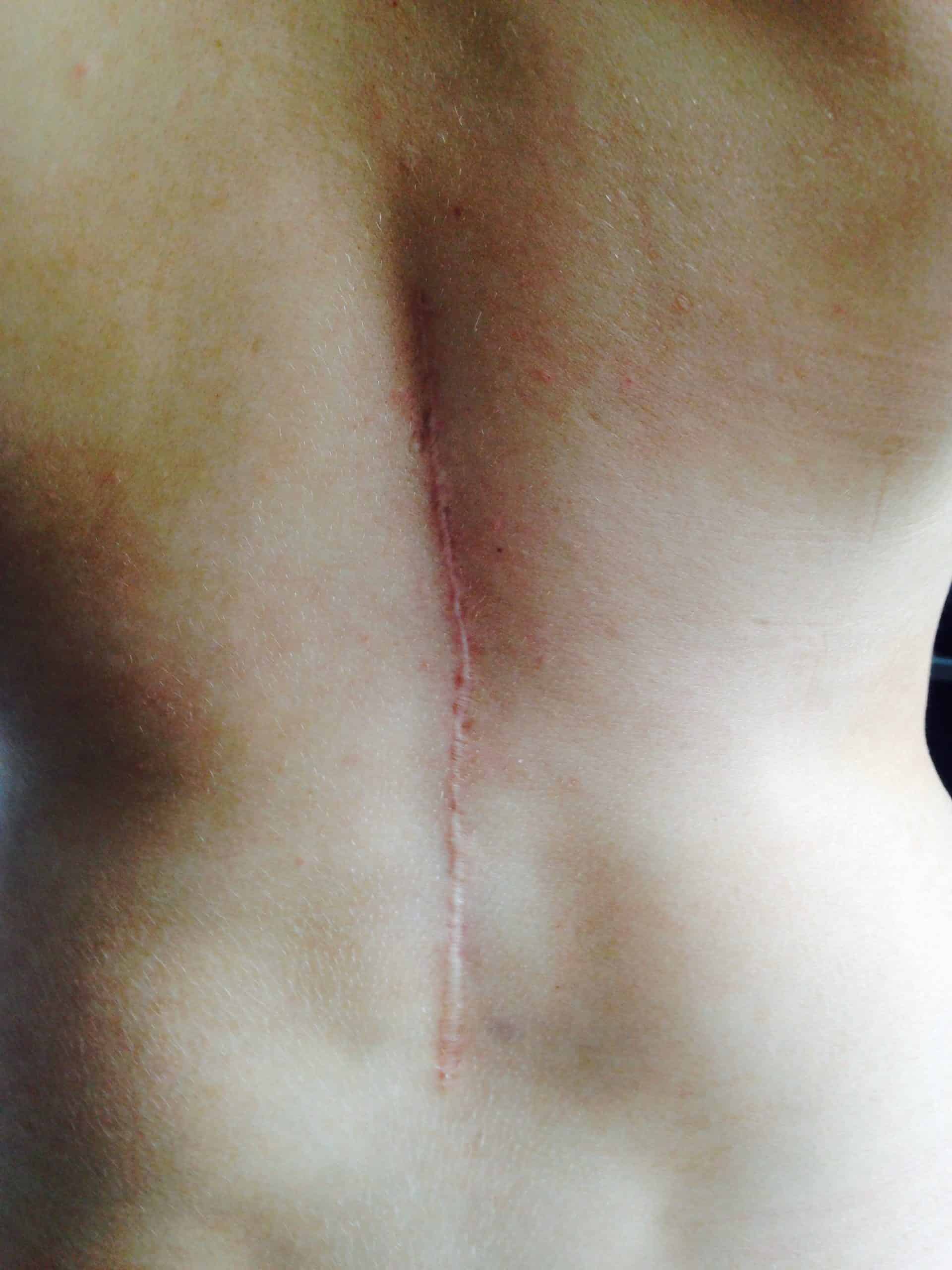 Înainte de utilizarea Nourisil™ MD