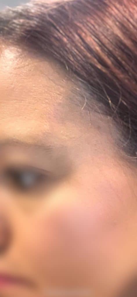 După utilizarea Nourisil™ MD