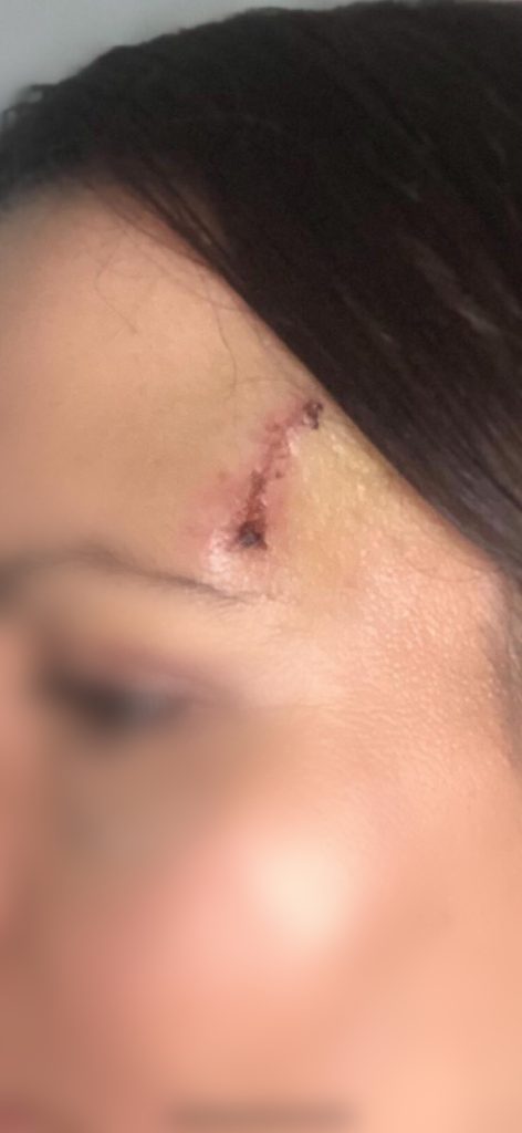 Înainte de utilizarea Nourisil™ MD